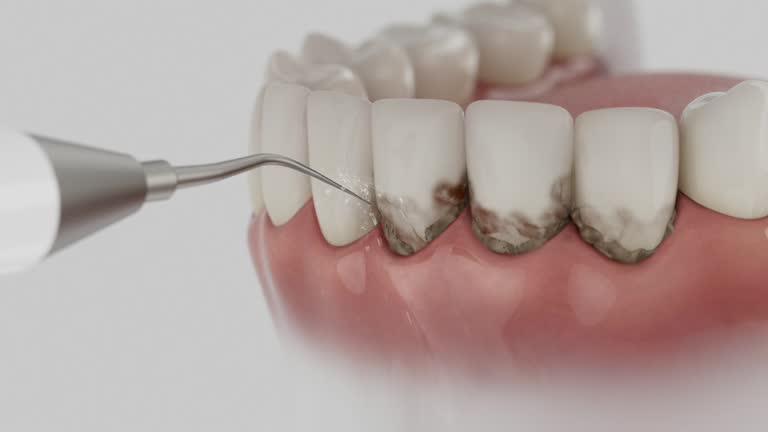 Reliable Dental contractor in De Motte, IN by Dentist Open Now